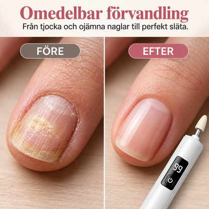 NagelPro™ – Professionell nagelvård hemma på några minuter